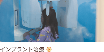 インプラント治療