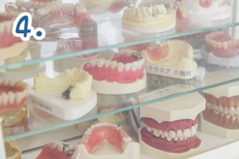 歯を出来るだけ抜かない矯正治療