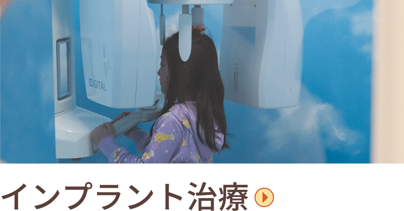 インプラント治療